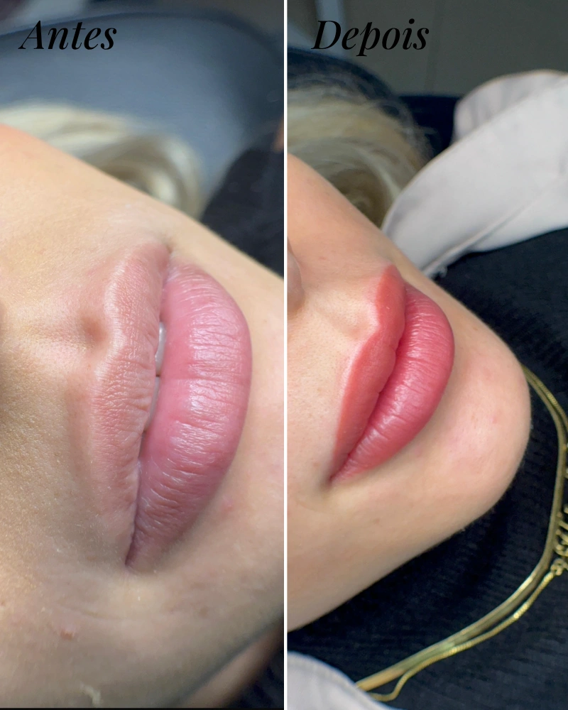 Antes e depois da micropigmentação labial
