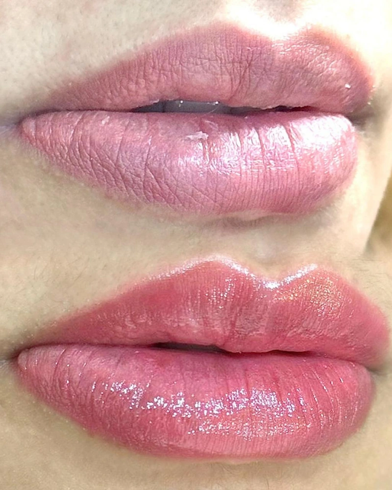 Resultado natural de micropigmentação labial InstaLips