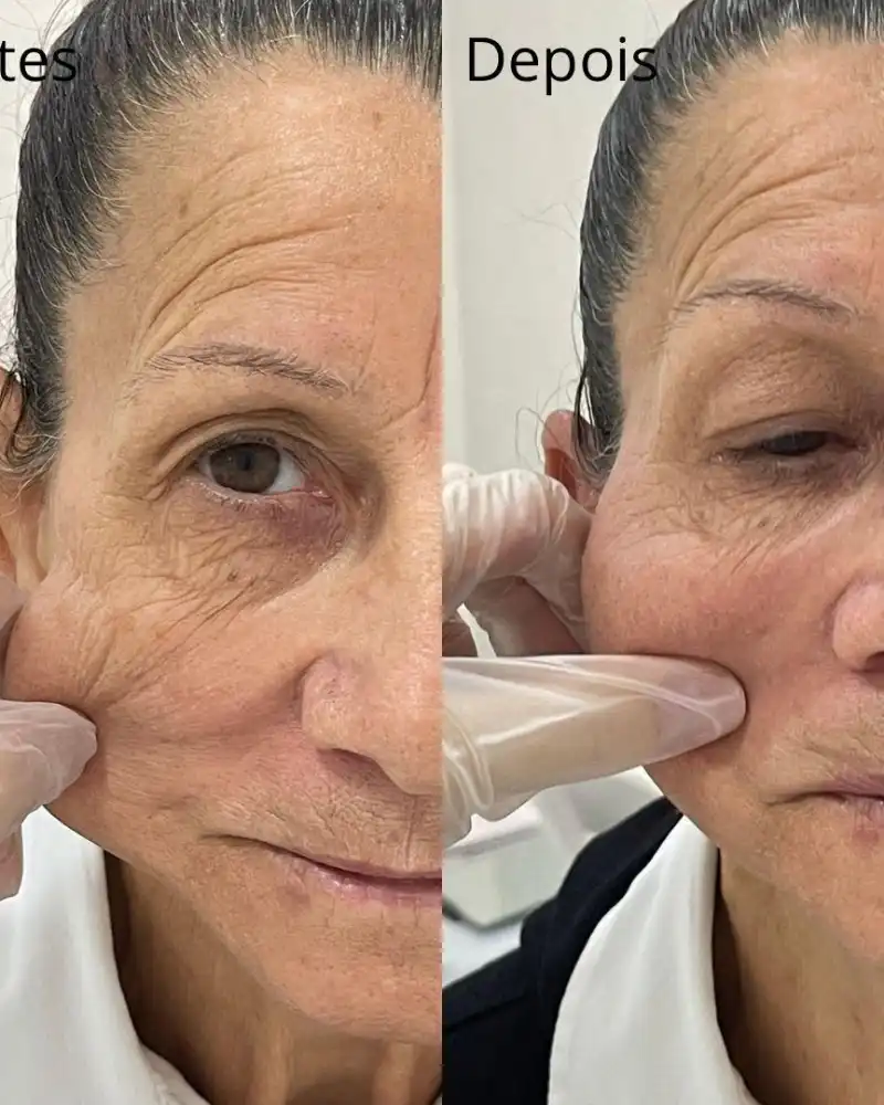 Antes e depois da micropigmentação de sobrancelhas